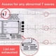 thumbnail image 5 of 2 unidades. Regla de ECG de 7 pasos, regla de ECG para interpretación de ECG/EKG, regla de referencia, herramienta de medición de calibrador de ECG, 5 of 5