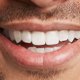 thumbnail image 3 of IGIA Total White 3 en 1 manos libres de dientes ultrasónicos, 3 of 4