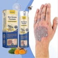 thumbnail image 4 of Soothing Moisturizing Psoriasises Liquid Portable Anti-itch Body Care Liquids Body Care Supplies, 4 of 5