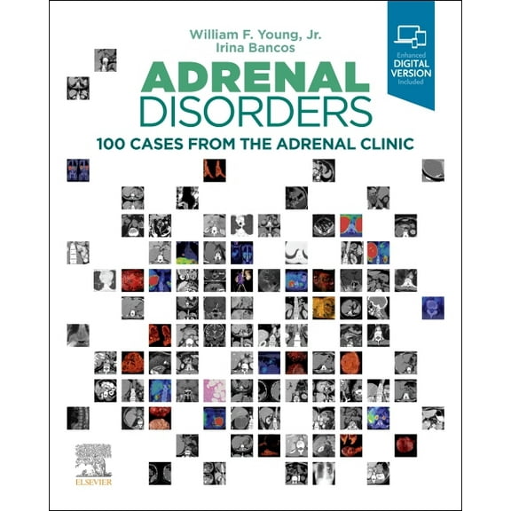 Adrenal Disorders: 100 Cases from the Adrenal Clinic, (Hardcover)
