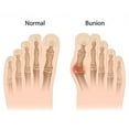 thumbnail image 4 of Bunion Corrector Night Splints for Bunion Relief Adjustable Bunion Pads for Hallux Valgus Correction and Orthopedic Hammertoe Toe Straightener for Foot Pain Relief (2), 4 of 6