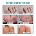 thumbnail image 3 of EELHOE Fungal Nail Treatment Liquid Nail Repair Moisturizing Anti-Hangnail Care Solution Cuticle Cream & Oil1PCS) -, 3 of 5