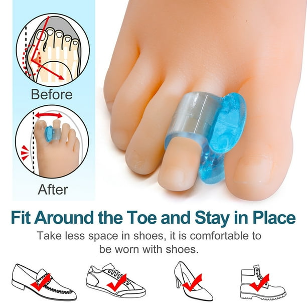 3 Pares De Separadores De Juanetes Suaves, Separador De Dedos De Gel De Silicona, Corrector De Pulgar, Herramienta Para El Cuidado De Los Pies ANGGREK Otros