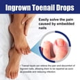 thumbnail image 3 of Ingrown Toenail Drops Treatment - Ingrown Toenail Pain Reliever and Softener Kit for Easy Trimming, Nail Care and Treatments, 3 of 8
