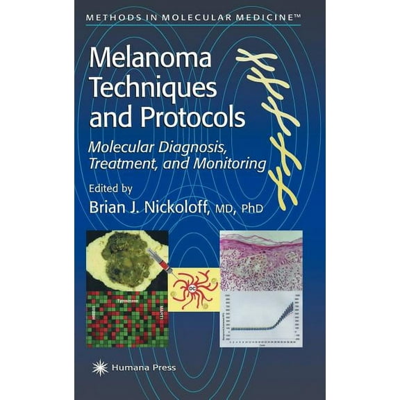 Methods in Molecular Medicine Melanoma Techniques and Protocols: Molecular Diagnosis, Treatment, and Monitoring, Book 61, (Hardcover)
