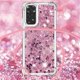 thumbnail image 4 of Funda FOXDOCK para Xiaomi Redmi Note 11/11s 4G con Cuerda Ajustable, Brillo Líquido, Protección Antigolpes y Lente – Ideal para Regalo, 4 of 6