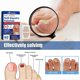 thumbnail image 3 of Multi Purpose Fungal-Nail Renewal Stickers, Strengthens Moisturizes Nail Care Stickers, for Nails Care Supplies, 3 of 5