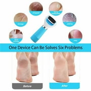 PEDEGG Electronic Foot File Roller, Callus Remover, USB Cable Included (Blue)