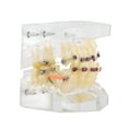 thumbnail image 3 of WALFRONT Dental Orthodontic Treatment Malocclusion Study Teeth Model With Wire Chain, Malocclusion Model,Orthodontic Model, 3 of 7