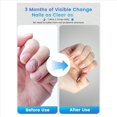 thumbnail image 5 of 2X Lámpara de Secado de Uñas para Uso Doméstico: Lámpara Portátil para Limpiar Uñas Gruesas, Dañadas y Descoloridas., 5 of 5