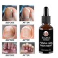 thumbnail image 2 of 30ml/50ml Fungus Care Repair Liquid Powerf, 2 of 4