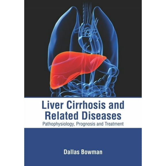 Liver Cirrhosis and Related Diseases: Pathophysiology, Prognosis and Treatment, (Hardcover)