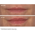 thumbnail image 6 of Hydro-Screen Lip Plumper - Pink Champagne, 6 of 11
