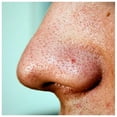 thumbnail image 4 of Seki Edge SS-801 Blackhead Remover, 4 of 5