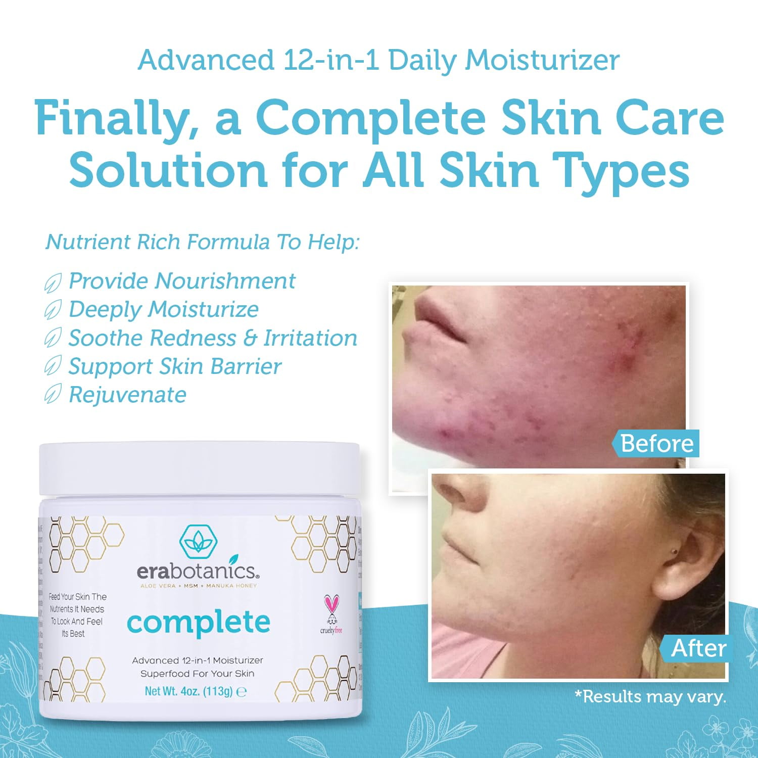 Era Organics Advanced Face Moisturizing 12-in-1 Anti Aging Wrinkle Dry & Sensitive Skin Cream for Face, Neck, Hands