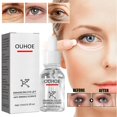 thumbnail image 1 of Suero antiarrugas para realzar los ojos, 15ml, esencia reafirmante para el cuidado de los ojos, 1 of 3