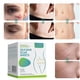 thumbnail image 2 of Silicone Scar Patch, Silicone Scar Tape Roll, Silicone Scar Strip, Reusable Scar Remover For Caesarean Portion, Keloid, Etc. 1.5M Long, 2 of 5