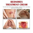 Decubitus Cream Pressure Sore Ulcer Skin Relief Ointment Bed Sore Wound