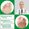 thumbnail image 6 of Bukihome 6 Pack Hammertoe Corrector Toe Straightener Curled Broken Toe Bunion Corrector for Women and Men,Size L,Clear, 6 of 7