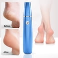 thumbnail image 1 of Feltree Charging Foot File with Multiple Speeds - Portable Callus Remover for Home Use, 1 of 7