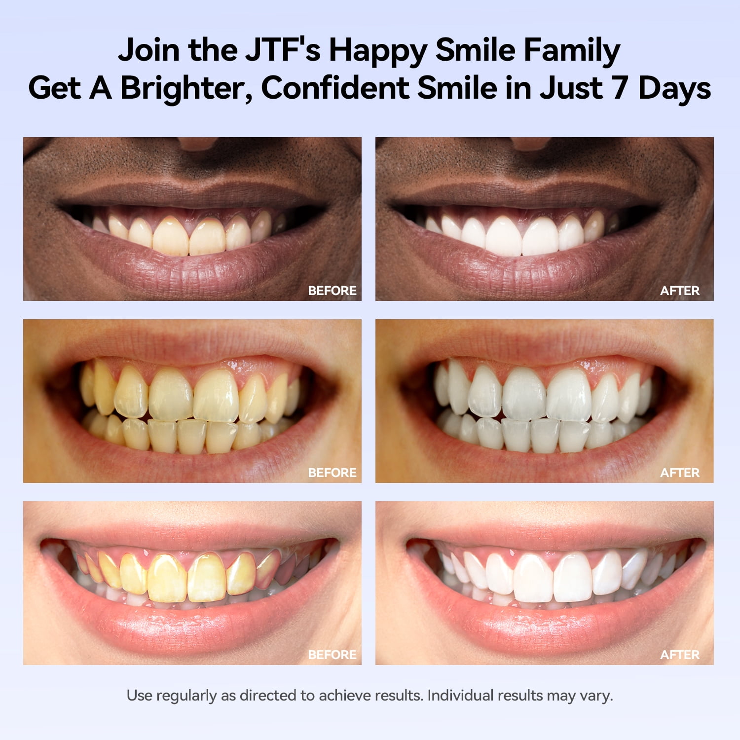JTF 8-Pack Teeth Whitening Gel Refills Kit, 7 Whitening Gels Containing 35% Carbamide Peroxide and 1 Remineralizing Gel for Stain Removal, Enamel Safe and No Sensitivity, Mint Flavor