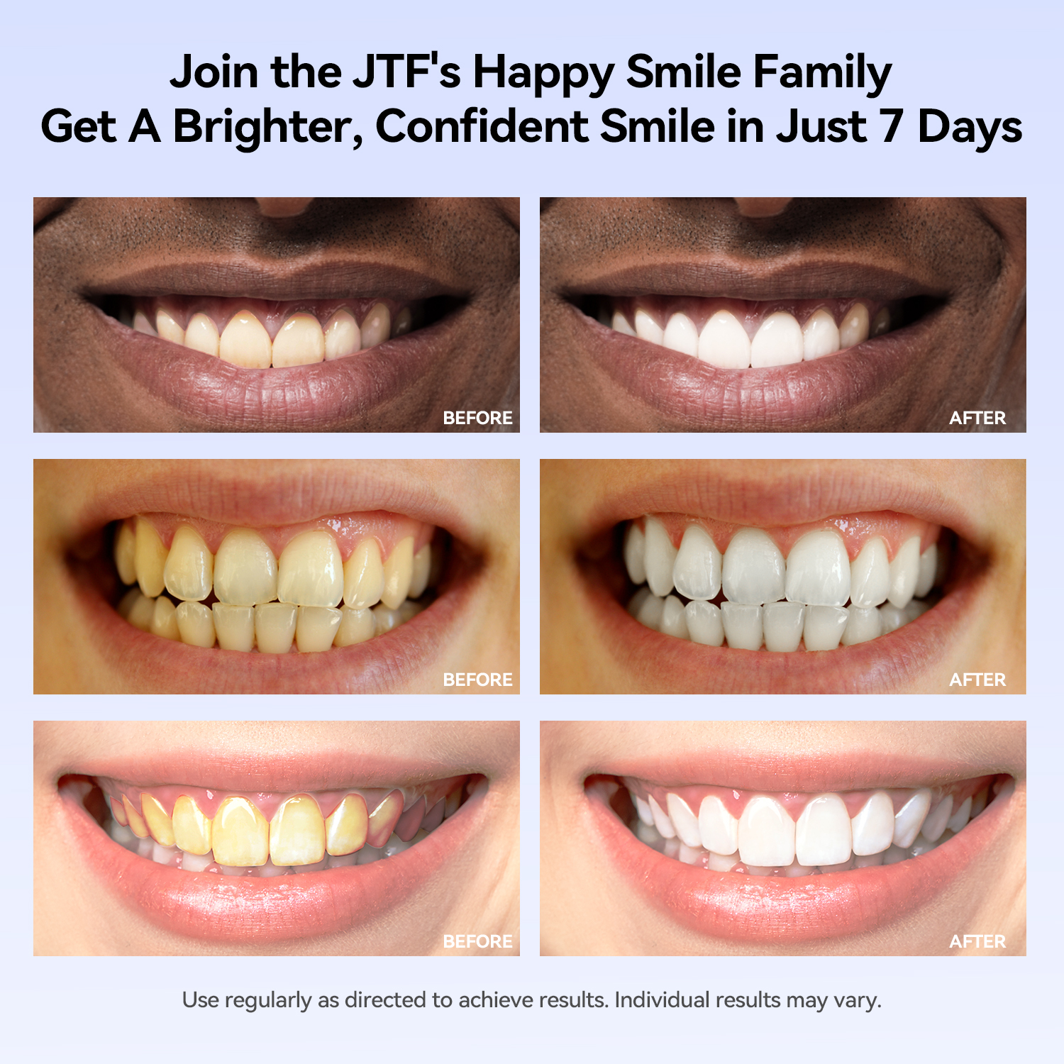 JTF Teeth Whitening Kit with LED Light photo 2