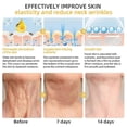 thumbnail image 3 of Anti-Aging Firming Cream, Professional Bee Venom Skin Firming Wrinkle Reducing Cream, Skin Firming Rejuvenating Cream, Restore Skin Elasticity for All, 3 of 5