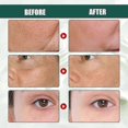 thumbnail image 4 of EELHOE deep anti-wrinkle essence fades fine lines and dark circles, adjusts skin tone, tightens, lifts and moisturizes skin care Anti, 4 of 4