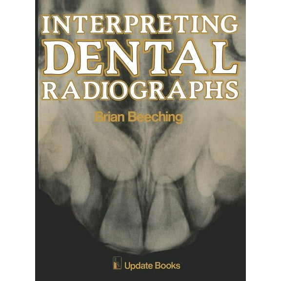 Interpreting Dental Radiographs, (Paperback)