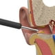 thumbnail image 4 of Cuchara Para Oreja, Herramienta De Eliminación De Cera De Oreja Lavable Visual Inteligente Para Recoger Orejas Yuarrent CE008128-00, 4 of 6