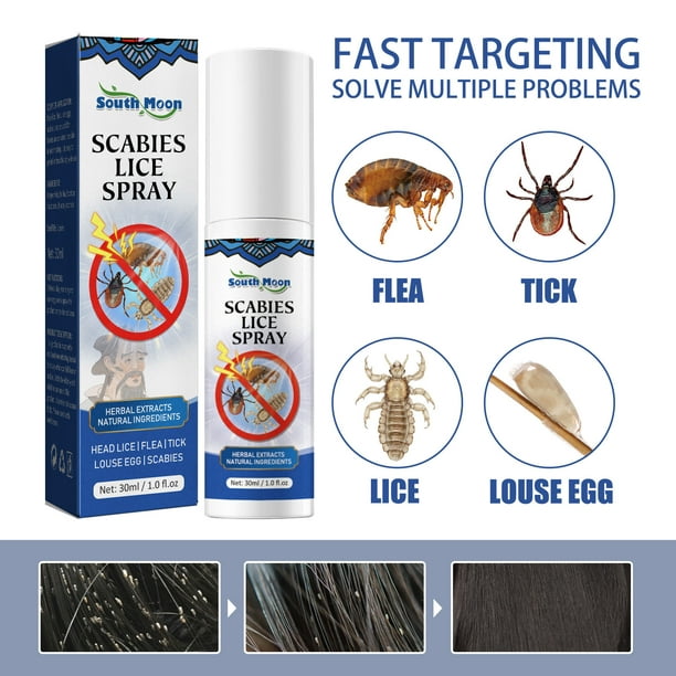 TMGONE Family Size Lice Kills For Kids & Adults, Easy Use Lice Spray Kills  Head Lice, Eggs, Super Lice On Contact 30ml(Buy 2 Get 1 Free) 