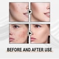 thumbnail image 5 of Jaysuing lactobionic acid liquid deeply cleanses, gently removes blackheads, exfoliates, shrinks pores and moisturizes the skin | |, 5 of 5