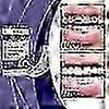 thumbnail image 3 of Teeth Whitening Strips | Home Teeth Whitening Strips, 3 of 5