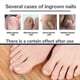 thumbnail image 2 of Toenail Sticker Sticke, 2 of 5