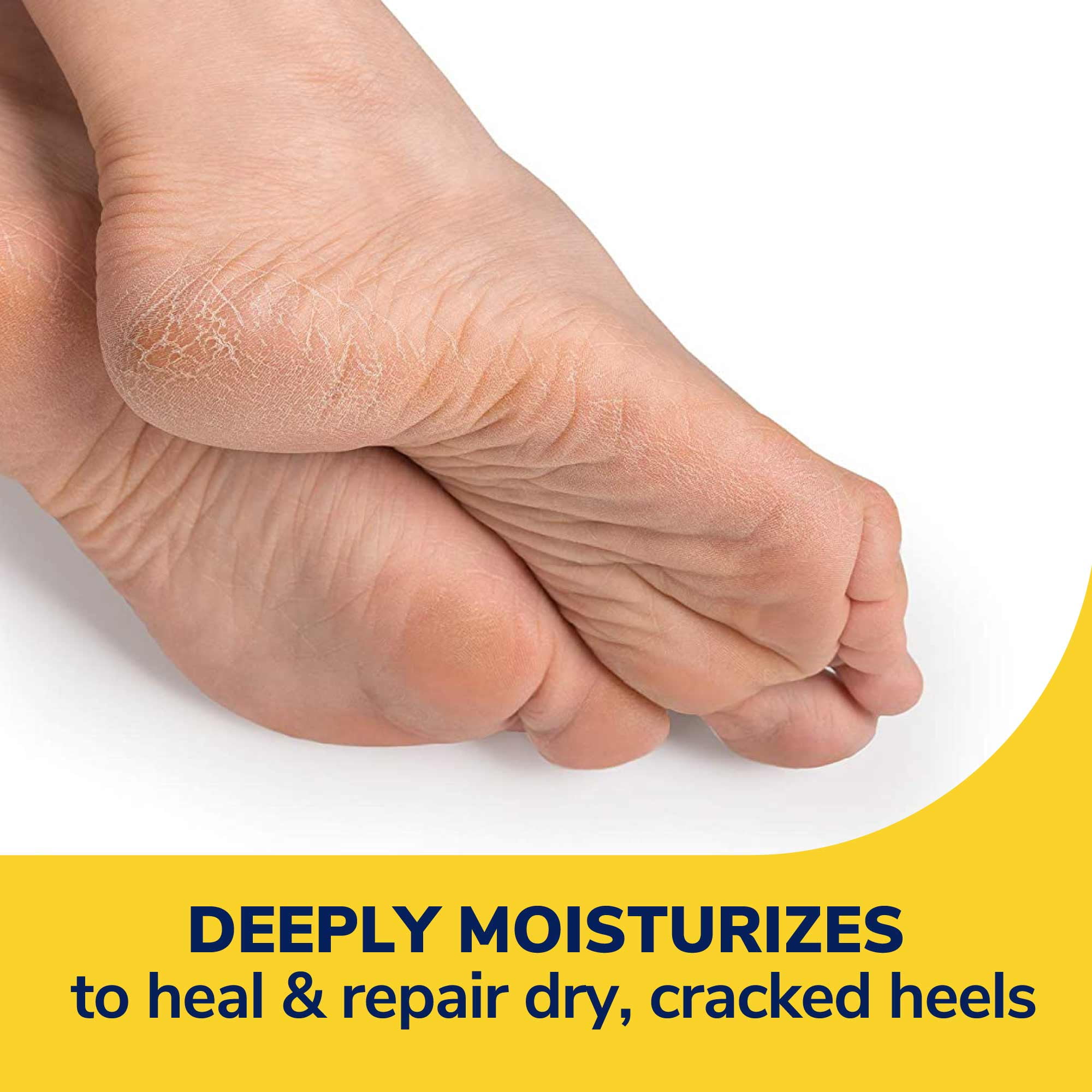 Dr. Scholl's Cracked Heel Repair Balm (2.5oz) 25 Urea. Heals and