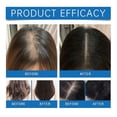 thumbnail image 4 of Scalpy Hair Growth Serum Anti Hair Loss Treatment for Men Women, Anti-Dandruff Itch Relief Hair Growth Roller, 4 of 5