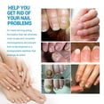 thumbnail image 5 of HHBEAUTY Nail Care Spray - Original Formula Toenail Treatment Extra Strength, Restores Appearance of Discolored/Damaged Nails, Toe and Fingernail Repair, Natural Ingredients, 5 of 9