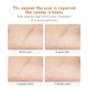 thumbnail image 4 of 30g Scar Gel Acne Scar Removal Cream For Removing Old Scars Burns, Cuts And Stretch Marks On Face And Body ANGGREK Scar Gel, 4 of 8
