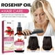 thumbnail image 4 of Fiudx Ofertas Flash Del Día Aceite De Semillas De Rosa Mosqueta, Hidratante Facial, Antienvejecimiento, Masaje Raspado, Rostro, Cabello Y Piel 30Ml, 4 of 6
