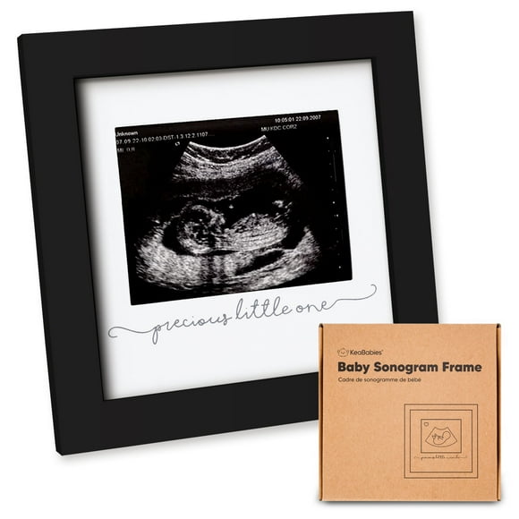 Sonogram Picture Frames