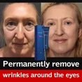 thumbnail image 5 of Crema antiarrugas de Retinol para hombres, elimina las bolsas de Ojos de círculo oscuro, hinchada, Reduce las líneas finas, partículas de grasa, hidratante, ilumina, 5 of 5
