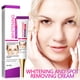 thumbnail image 4 of Fiudx Crema Iluminada, Crema Facial Inhibidora de Melanina, Loción Suave para La Piel, Reduce La Pigmentación, Elimina Pecas y Renueva La Piel, Cuidado para Piel Sensible, Absorbente No Grasa, Mejora, 4 of 7