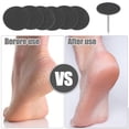thumbnail image 2 of Vocoste Sandpaper Disk Replacement Pad Foot File Callus Remover Tool Fine 150 Grit 25mm 100 Pcs, 2 of 7