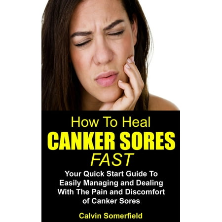 How To Heal Canker Sores Fast: - eBook (Best Way To Heal Canker Sore)