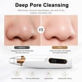 thumbnail image 4 of Lefinee Blackhead Remover Vacuum, Usb Rechargeable Facial Pore Cleaner with 3 Suction Levels for All Skin Types, 1 Pack, 4 of 6