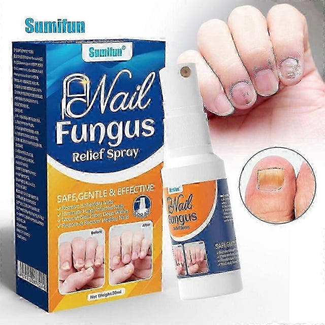 Extra Strong Fungal Nail Treatment - Effective Solution For Finger & Toenail Fungus, Protects Thick, Broken, Discolored Nails, Restores Discolored Nai