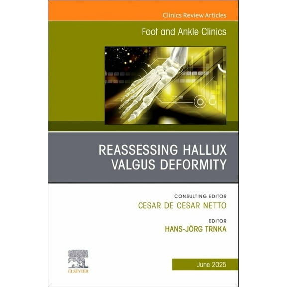 Clinics: Orthopedics Reassessing Hallux Valgus Deformity, an Issue of Foot and Ankle Clinics of North America: Volume 30-2, Book 30, (Hardcover)