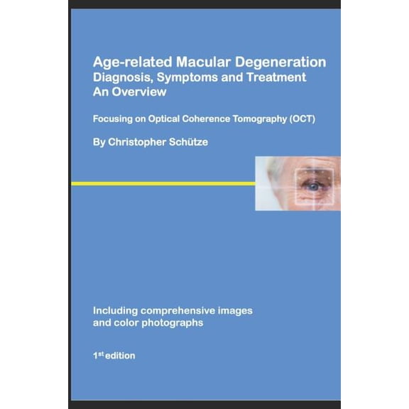 Ophthalmology Series No. 1 Age-related Macular Degeneration, Diagnosis, Symptoms and Treatment, An Overview: Focusing on Optical Coherence Tomograp, Book 1, (Paperback)