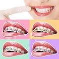 thumbnail image 3 of QUUPY 1040 Pcs Multi-Color Orthodontic Ligature Ties,O-Rings Braces Rubber Bands, 3 of 8