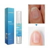 Anti Fungal Nail Treatment Finger Toe Care Nail Fungus Treatment Liquid Pen 4ml